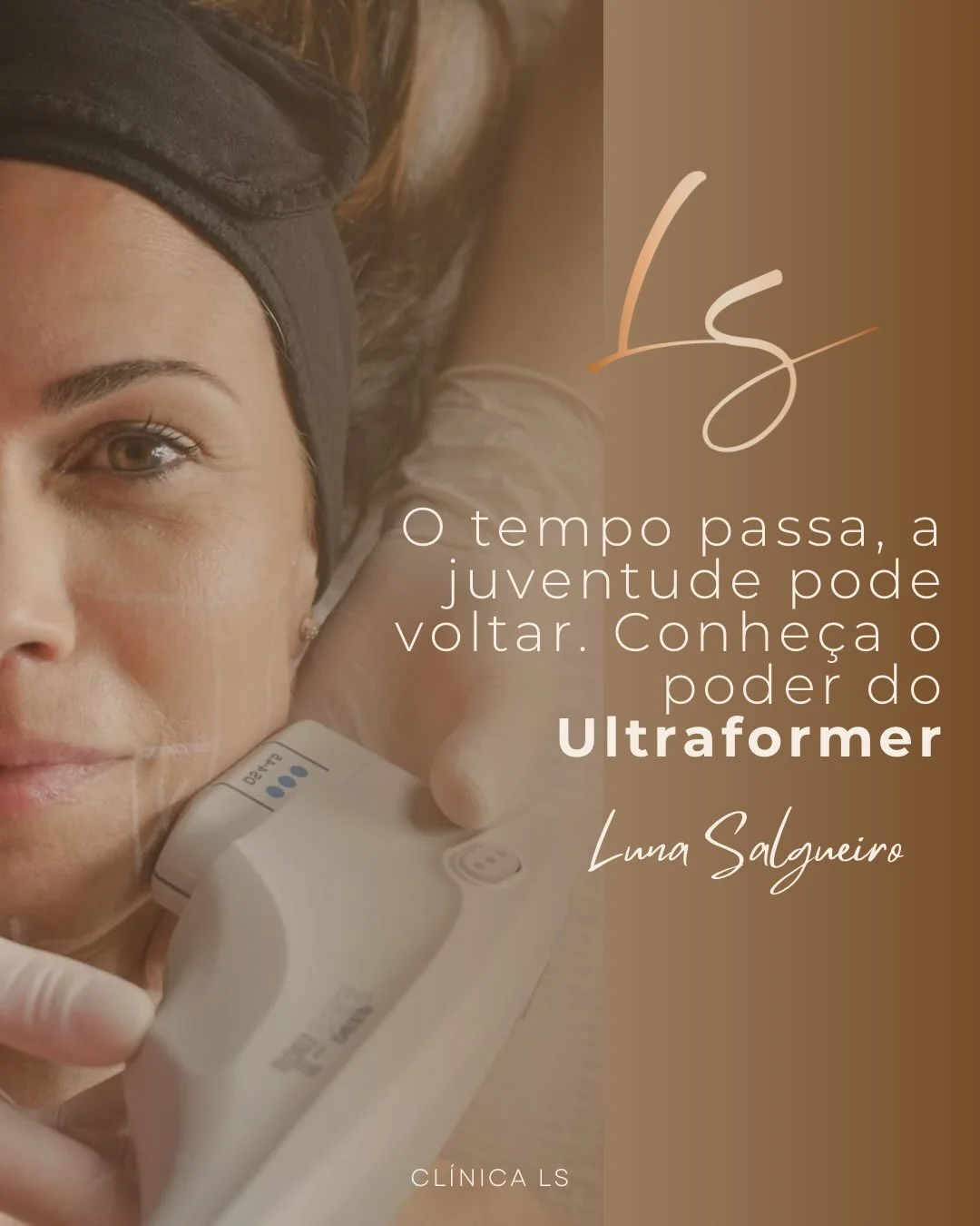 O tempo passa - Ultraformer